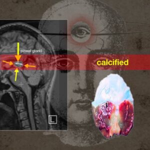 I finally decalcified my pineal gland! Here's how